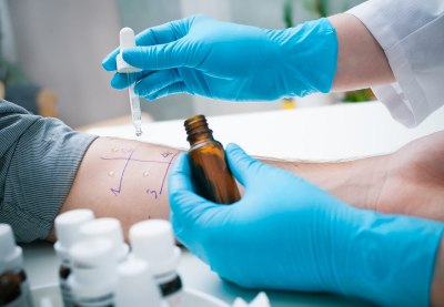 Consultas e testes com médico alergista disponibilizados no Hospital Municipal Manoel Carola